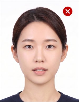 입 벌림