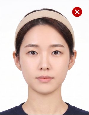 정수리 가림
